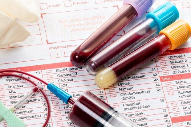 آزمایش خون جدید 20 نوع سرطان را شناسایی می کند