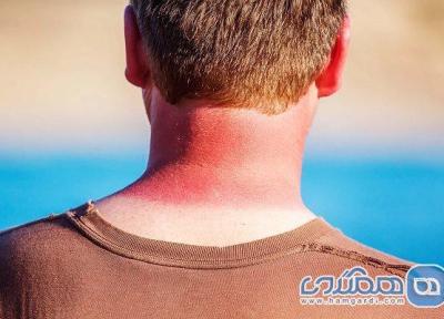 چطور در سفرهای ساحلی دچار آفتاب سوختگی نشویم؟