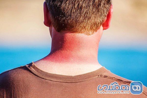 چطور در سفرهای ساحلی دچار آفتاب سوختگی نشویم؟ چطور در سفرهای ساحلی دچار آفتاب سوختگی نشویم؟